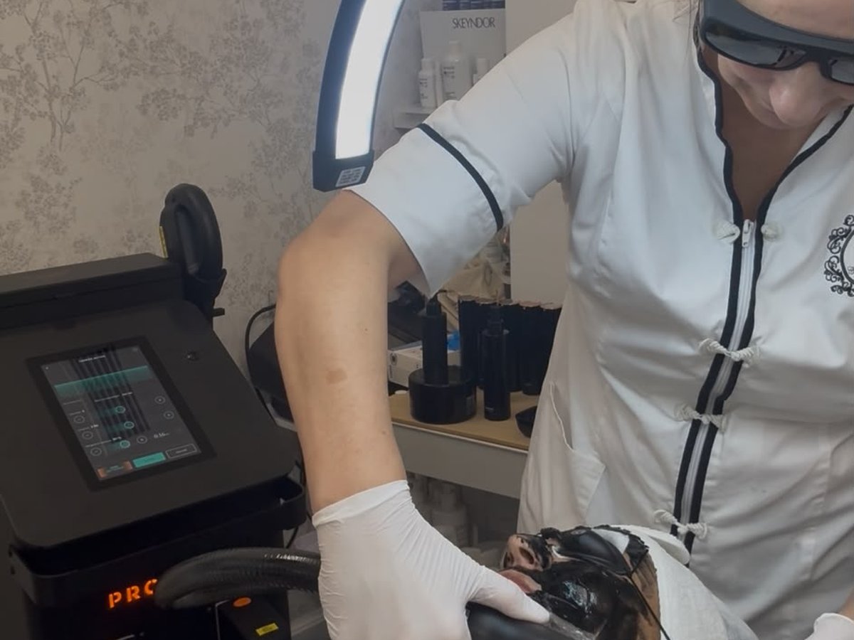 Peeling de carbón activo con FHOS Bioluminiscente Procyon en Esencia Estética Campo Real