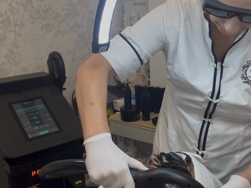 Esteticista de Esencia Estética con gafas de protección durante la sesión de carbón activo con Procyon FHOS