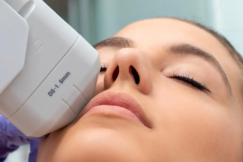 HIFU 7D Ultramage facial lifting sin cirugía Campo Real