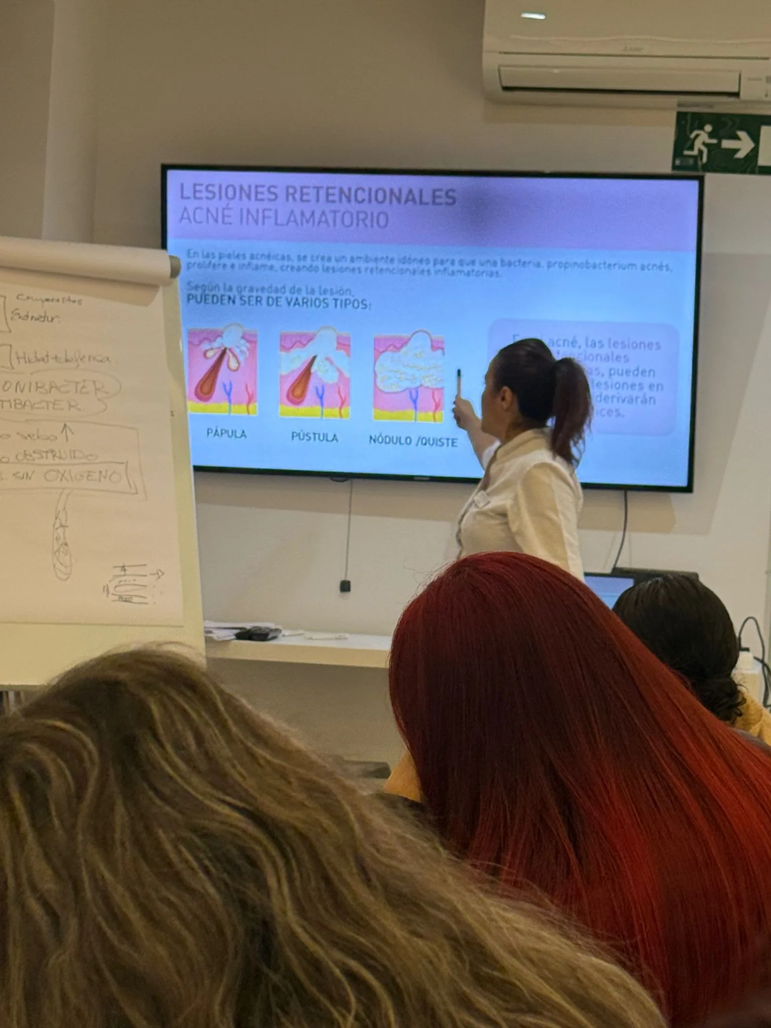 Pantalla didáctica con anatomía de la piel mostrando los tipos de lesiones acneicas: pápula, pústula, nódulo y quiste